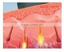 Professional Multifunction IPL SHR Hair Removal Laser beauty machine with Elight made in China