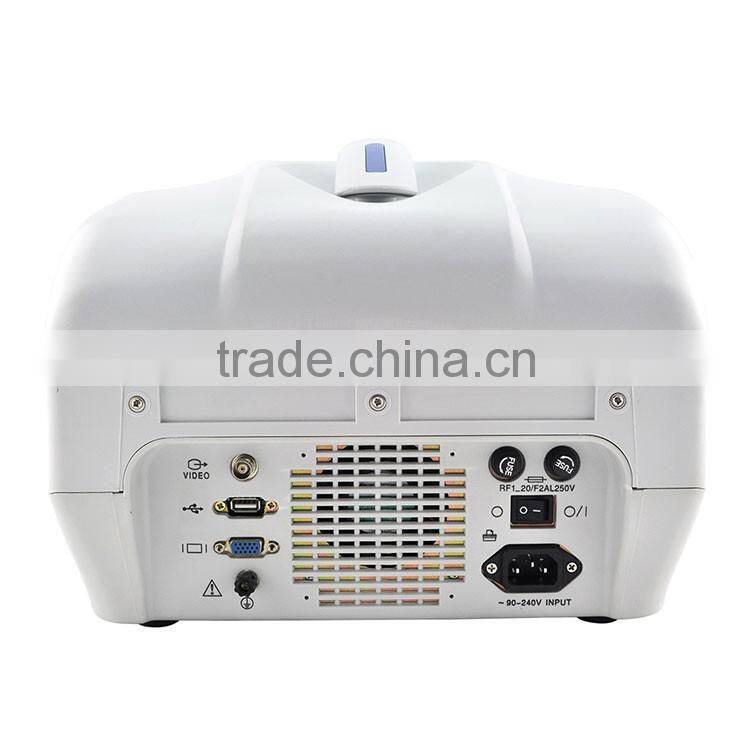 CE approved 3.5Mhz multi-frequency convex probe Portable veterinary ultrasound scanner