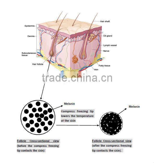 2015 fast selling! Permanent hair removal treatment SHR rf e light equipment