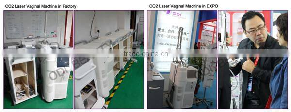Alibaba express vaginal tightening co2 fraction laser OD-V8