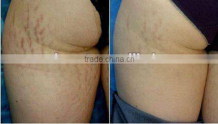 Handheld Massage Roller/Facial Beauty Roller L007