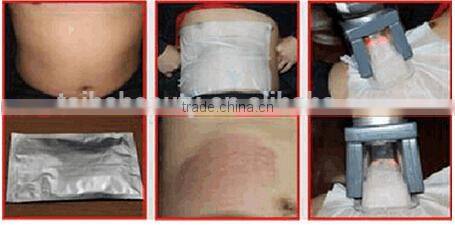 Mini Cryolipolyisis weight loss machine looking for distributors or agents