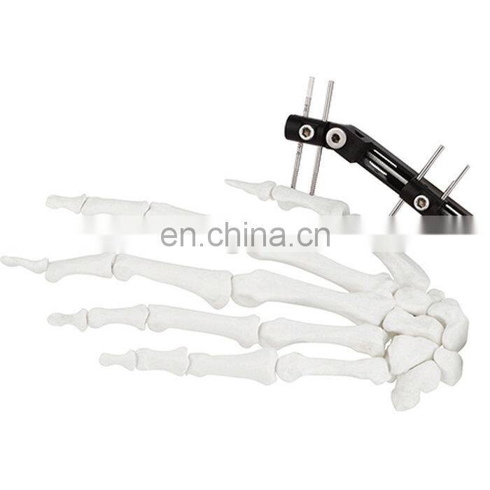 CE & ISO Marked Mini Fragment External Fixator (Finger and Palm) Surgical Instrument