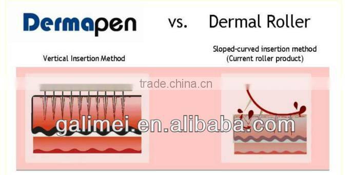 Home use micro-needle skin roller dermaroller alibaba china Device