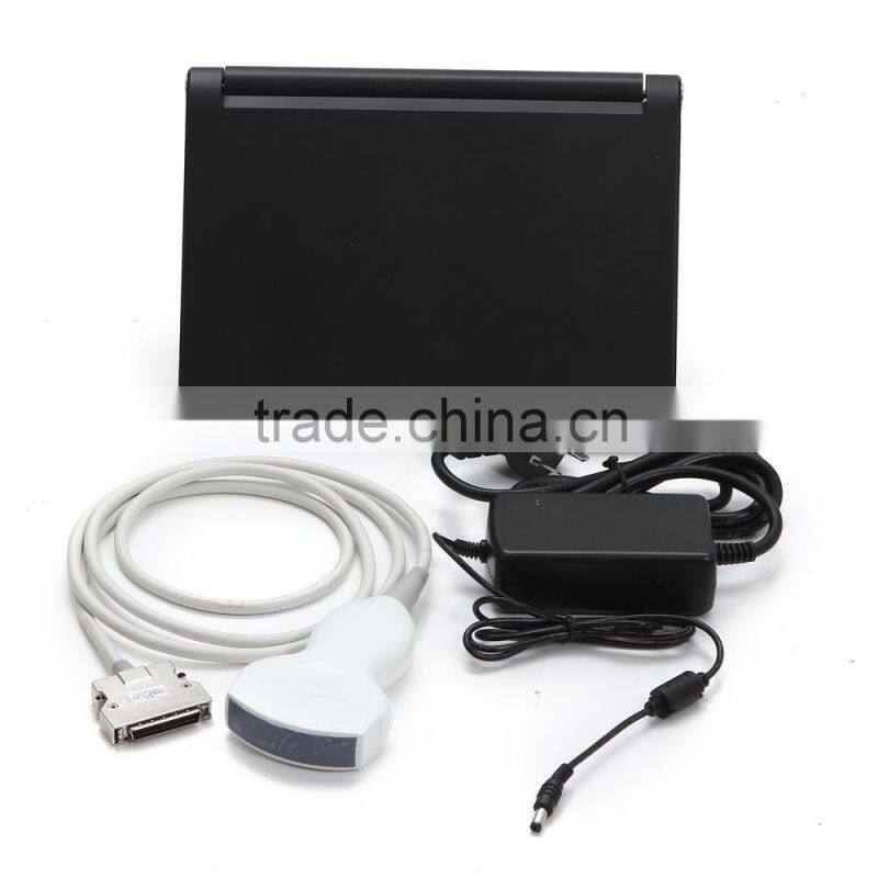 Mini Laptop CE Approved Cheap Price Pregnant Diagnosis Ultrasound Scanner Machine with Probe/Transducer-RUS-9000F