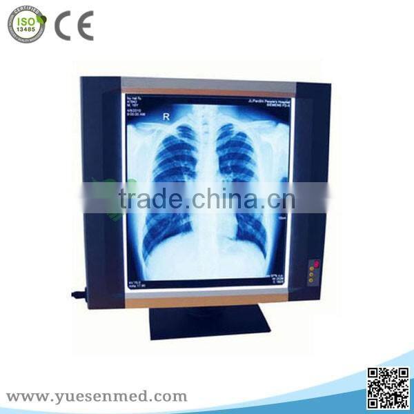YSX1704 Cheapest hot sale medical LED radiography film viewer