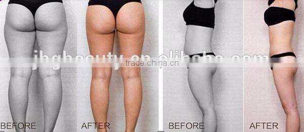 ce approval hifushape liposonic body slimming machine wholesale price
