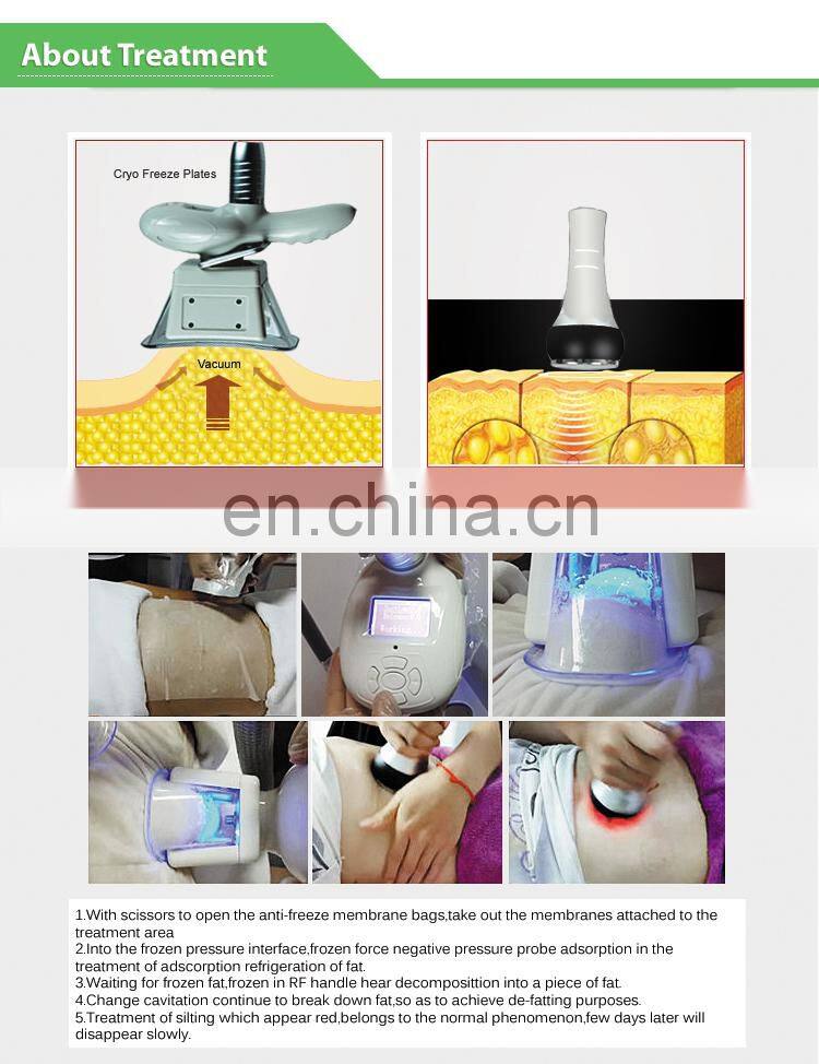 Popular Fat freezing /cryolipolysis slimming machine/criolipolisys machine