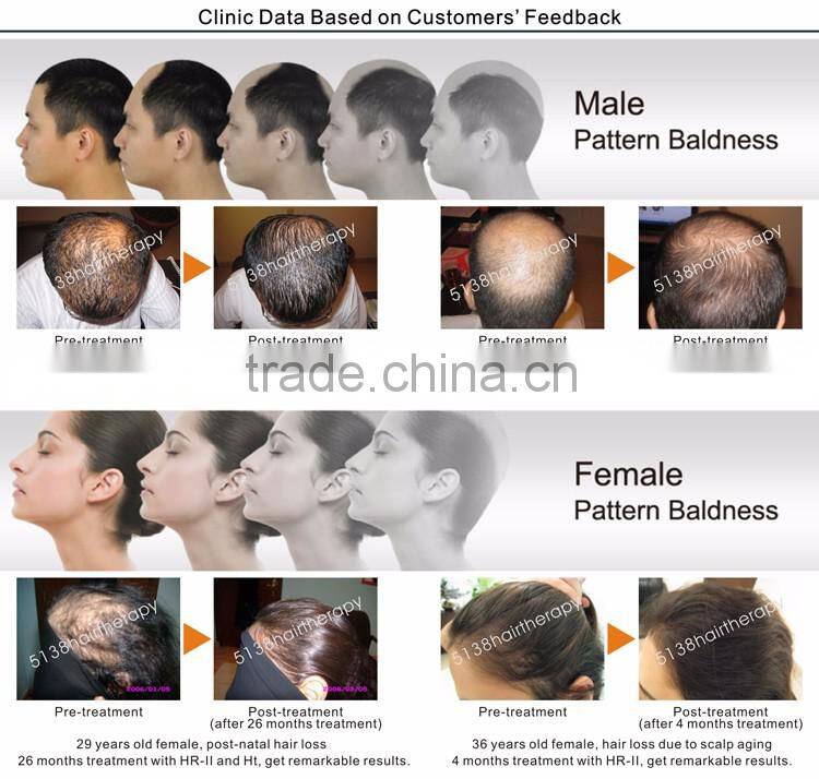 Laser Cap Hair Regrowth Beauty Salon Equipment Laser Cap Hair Regrowth HR-II