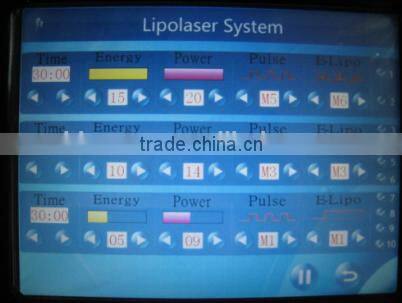 how much lipo laser machine