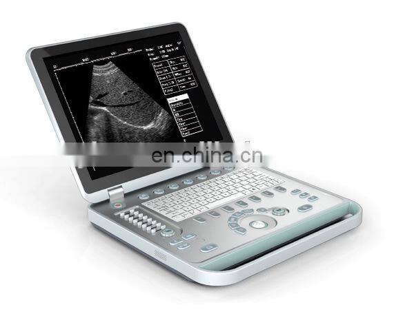 15 inch 2D/3D B/W Laptop digital portable ultrasound units