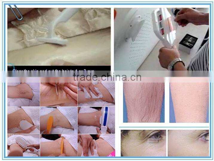 best selling products shr ipl rf nd yag Laser Beauty Equipment