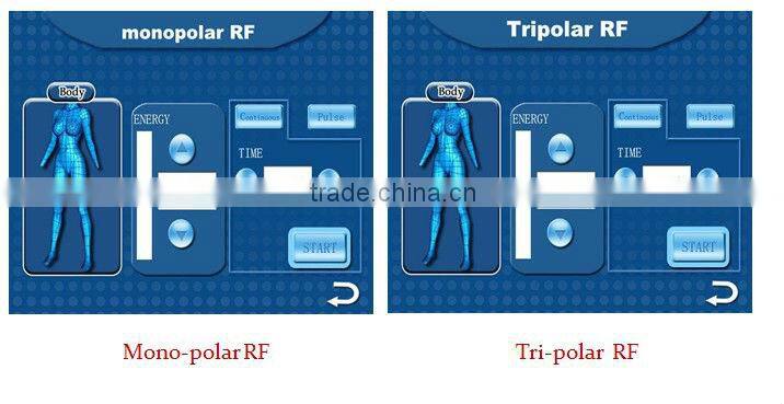 2016 Hot 5 treatment handles cavitation radio frequency ultrasonic facial beauty equipment for salon use