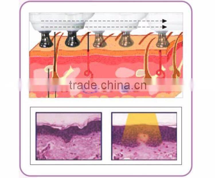 DEESS mini rf anti-aging skin rejuvenation pore removal machine at home use use daily home items beauty equipment