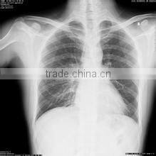 medical film thermal meter printer Medical laser paper film