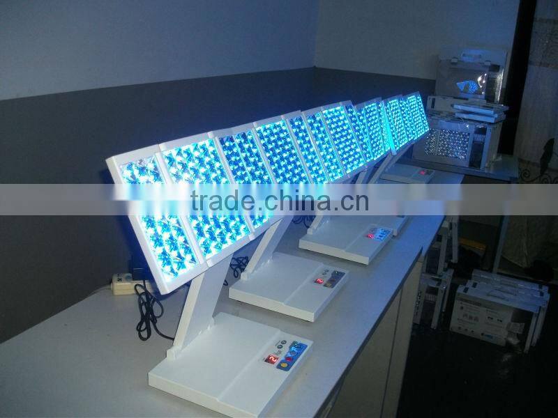 HOT!!!2014 best selling spider vein removal machine,laser vein removal machine for sale