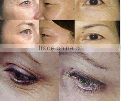 Elight ipl hair removal machine for sale C001