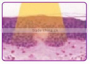 Home rf skin tightening machine facial skin rejuvenation device for anti aging with CE PSE ROHS certificates