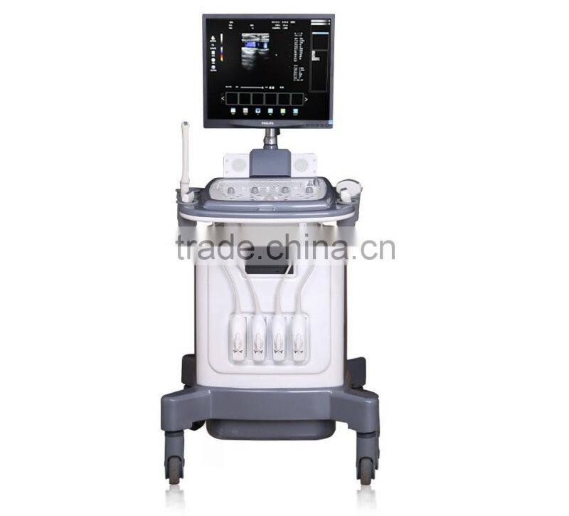 Echo Color Doppler 3D Function Laptop/Notebook Ultrasound