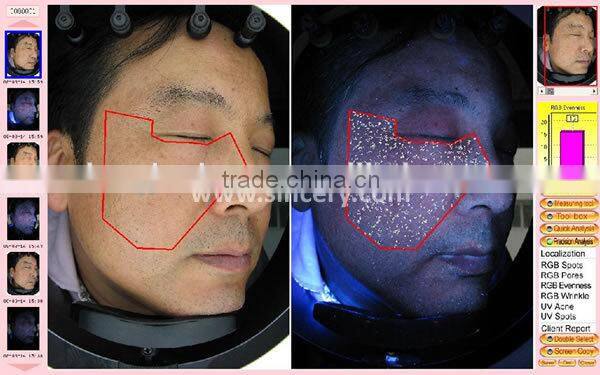 BS-1200P Portable Skin Oil,Wrinkle and Physical Feature Analyzer Face Scanner Machine