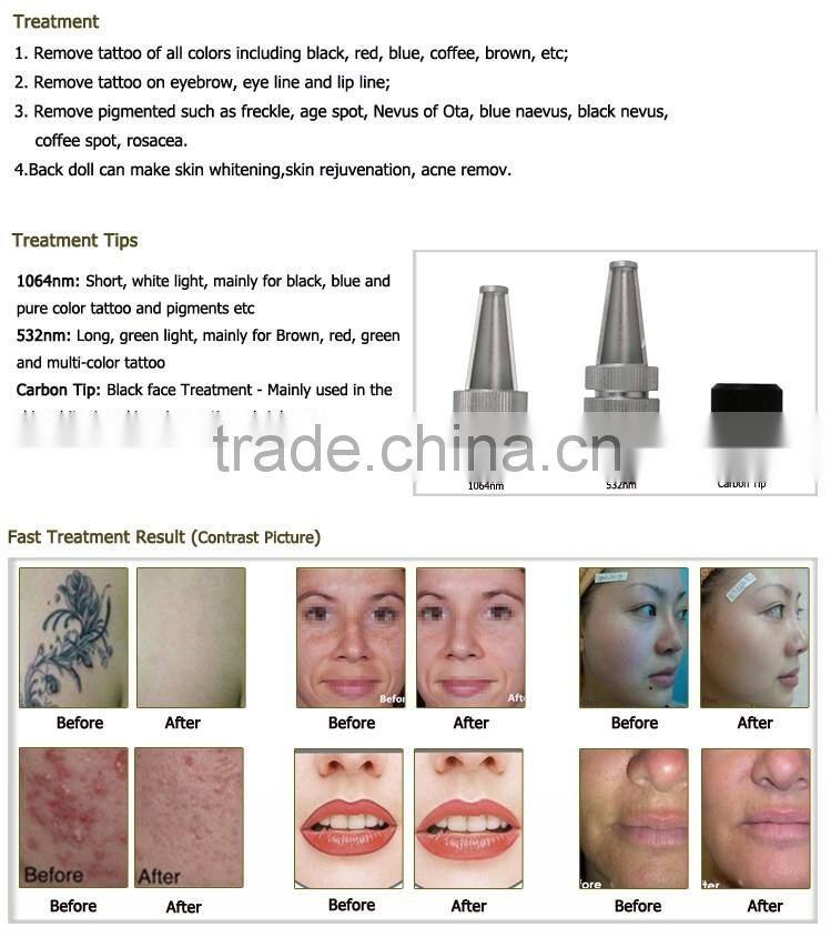 big sale laser tattoo removal machine active q switch nd yag laser tattoo removal pigment removal beauty equipment machine