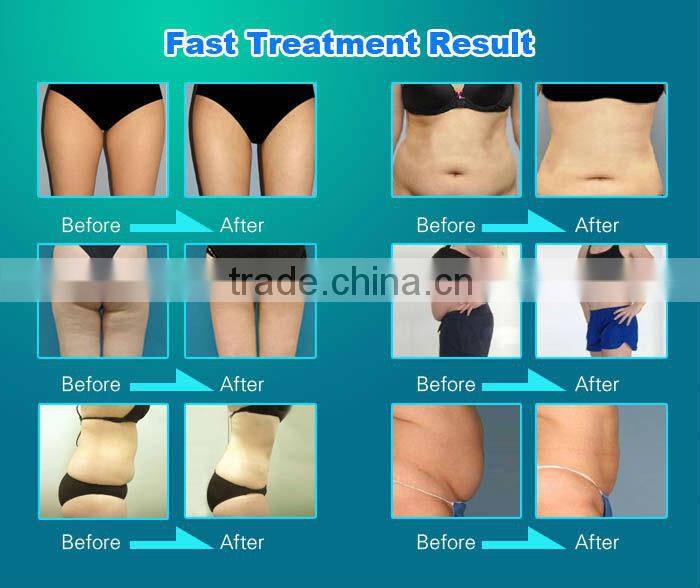 Hot sale portable 7s anti cellulite and wrinkle machine/arm fat reduction machine