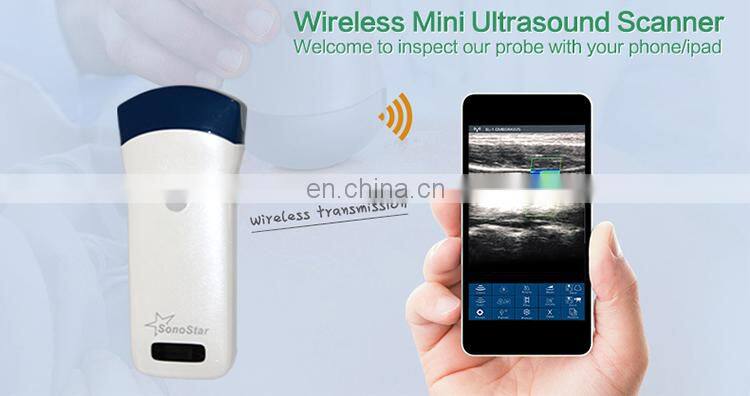 Sales 2022 factory price portable wireless ultrasound scanner ultrasound machine