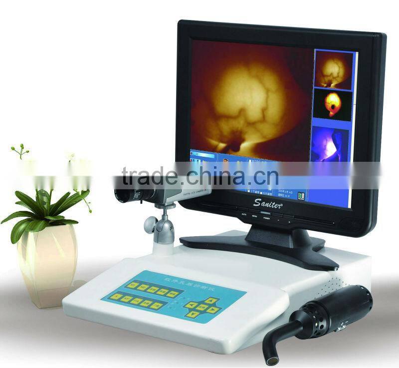 Professional Infrared Mammary Gland Inspection Equipment for mammary diseases
