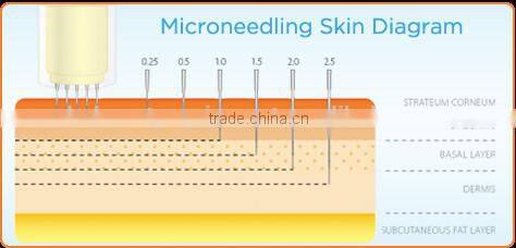 2015 facial electric shock pen for scar remove