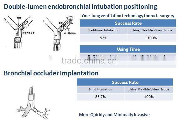 2.2 mm Working Channel Flexible Video Medical Endoscope Camera Endoscopy Compare Fiber Optic Video Olympus Bronchoscope