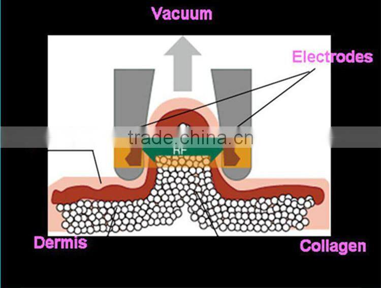 China manufacturer cavitation rf vacuum body slimming machine