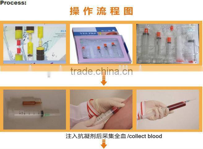 Portable centrifuge, ppp centrifuge, heated centrifuge, temperature controlled centrifuge TDD-3MC