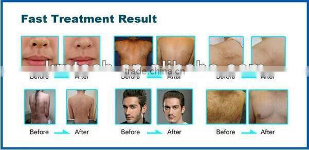 Professional beauty facial cleaning appliances with skintighting