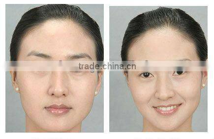 beauty nd yag laser eye line eyebrow lip line tattoo removal machine