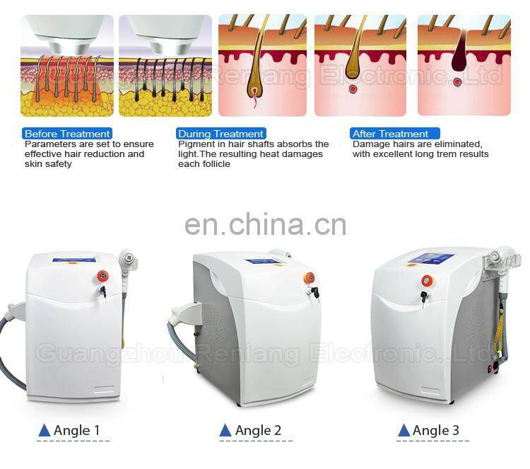 Newest Portable 808nm laser hair removal home from china
