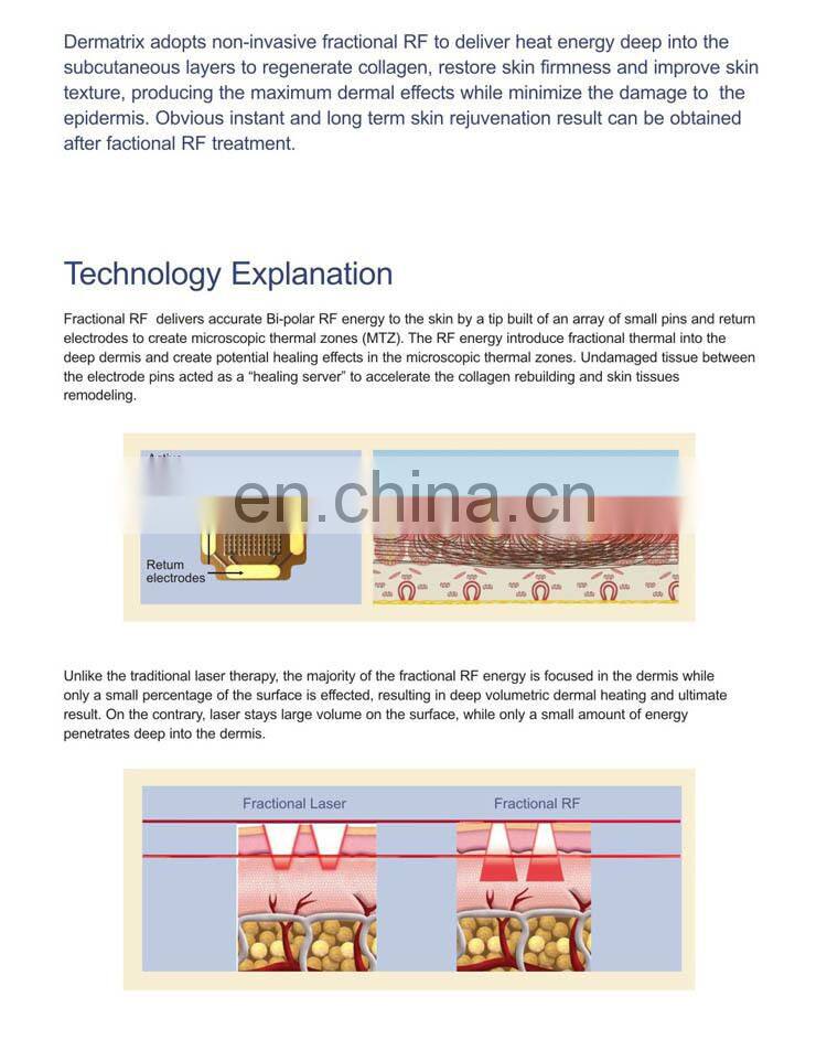 Fractional Micro needle RF Anti aging /scar removal beauty Machine