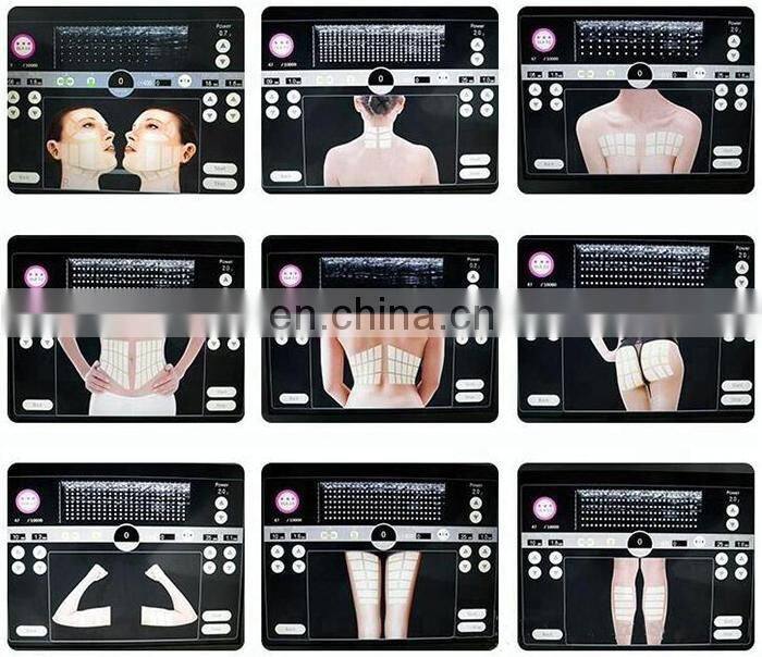 Portable Ultrasonic 3D Anti-aging High Intensity Slimming Machine Face Lifting Wrinkle Removal