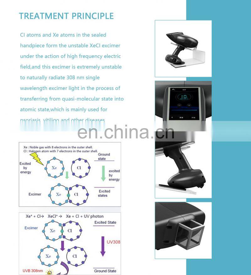 Portable Mini UVB Lamps Psoriasis Vitiligo Treatment Machine 308 Excimer Laser For Skin Disease
