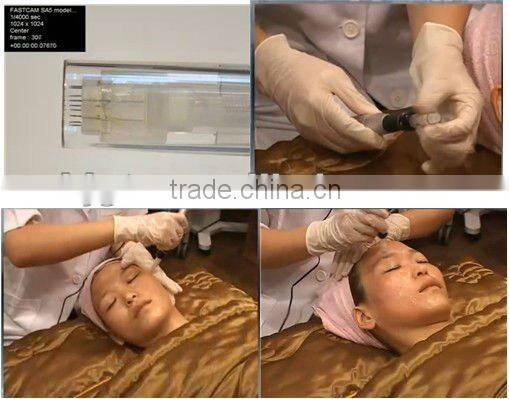 professional micro needle pen/anti ageing/anti wrinkle/electric derma beauty pen(CE approved)
