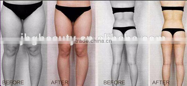 ce approval hifushape liposonic body slimming machine wholesale price