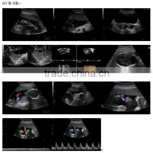 3D and 4D Color Doppler with 4D Real Time Live Probe iSpark 480plus/option Trans-vaginal Array Probe (180)