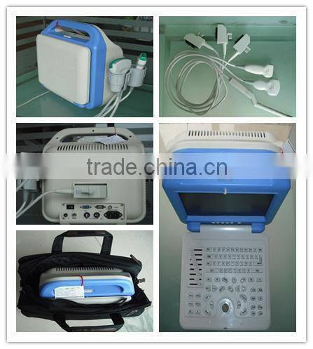 Portable LCD Display Ultrasound Scanner AJ-6100B LCD