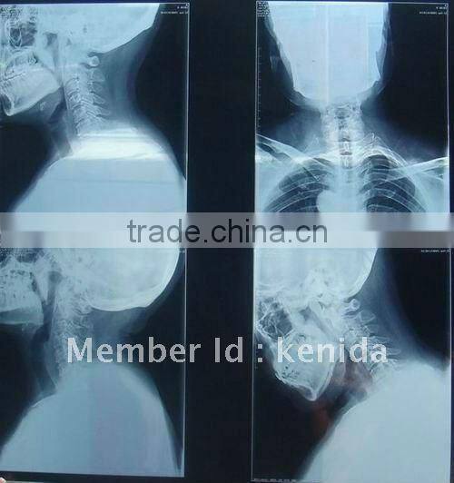 Manufacturer of films,medical dry imaging film with CE,konida x ray film,fit for with fuji and agfa printers