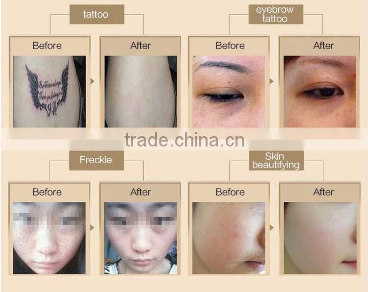 Active Q-Switch EQ Powerful 1064nm 532nm q-switch nd yag laser / nd yag laser machine