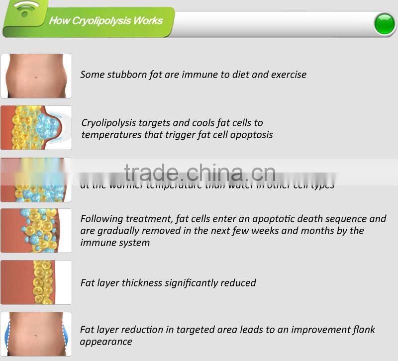 Cryotherapy cryolipolysis slimming equipment, 3 interchangeable cryo handles
