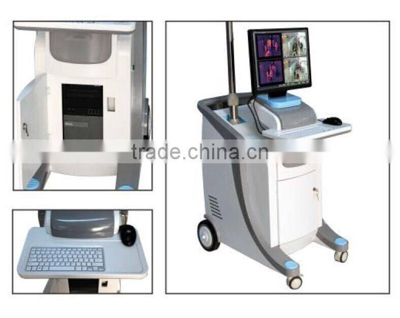 Infrared Thermal Imaging Temperature Measurement System for Ebola virus