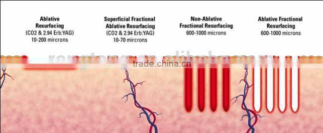 co2 laser beauty equipment
