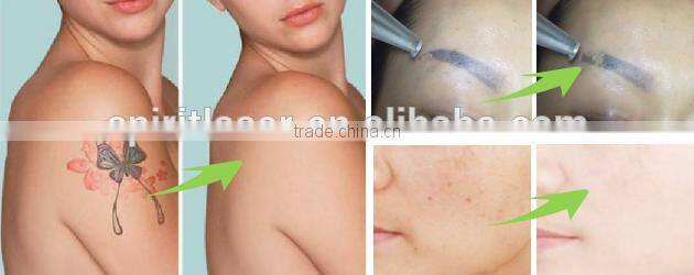 IE-11 Spiritlaser fda approved ipl laser nd yag q-switched