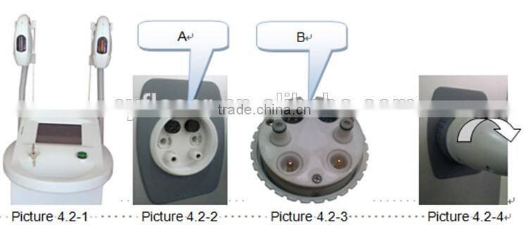 IPL Skin Rejuvenation and Hair Removal Portable IPL / photo skin rejuvenation