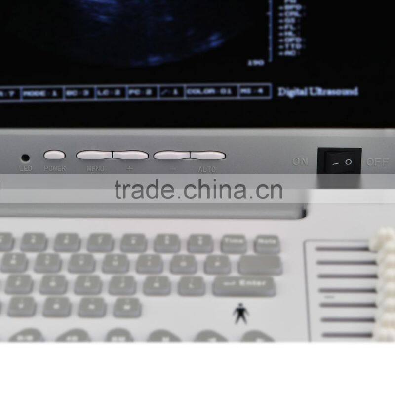 2016 Large Screen Cheapest Portable Ultrasounic Diagnosis Scanner Machine System with Convex/ Linear Transducer and Sony Printer
